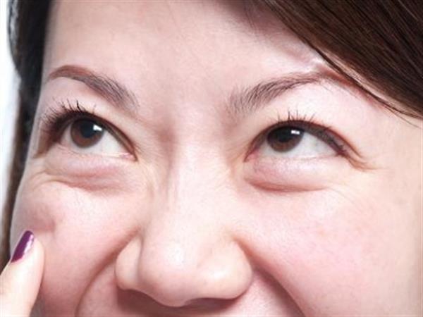 熱熔<a href=http://www.f3bb6.cn/listinfo-708-0.html target=_blank class=infotextkey>去眼袋</a>疼嗎