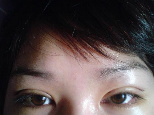 割<a href=http://www.f3bb6.cn/listinfo-724-0.html target=_blank class=infotextkey>雙眼皮</a>多久自然