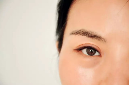 透明質(zhì)酸豐太陽后頭好痛正常嗎