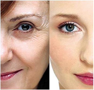 注射botox<a href=http://www.f3bb6.cn/listinfo-614-0.html target=_blank class=infotextkey>除皺</a>瘦型素<a href=http://www.f3bb6.cn/listinfo-614-0.html target=_blank class=infotextkey>除皺</a>瘦型素<a href=http://www.f3bb6.cn/listinfo-614-0.html target=_blank class=infotextkey>除皺</a>安全嗎