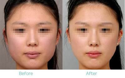 怎樣<a href=http://www.f3bb6.cn/listinfo-631-0.html target=_blank class=infotextkey>瘦臉</a>加快