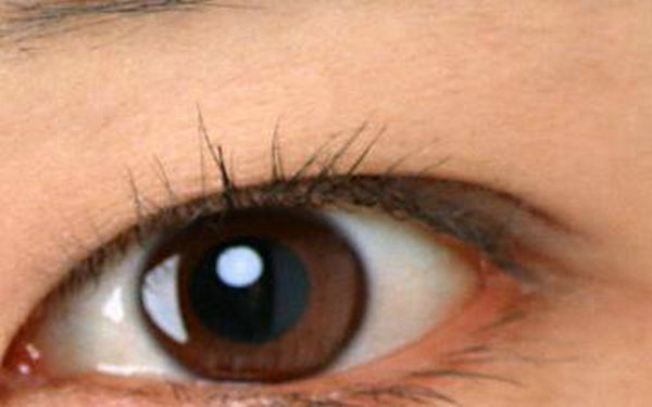 切割<a href=http://www.f3bb6.cn/listinfo-724-0.html target=_blank class=infotextkey>雙眼皮</a>要多少錢?