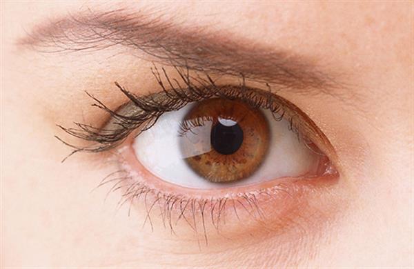 內切眼袋多久恢復