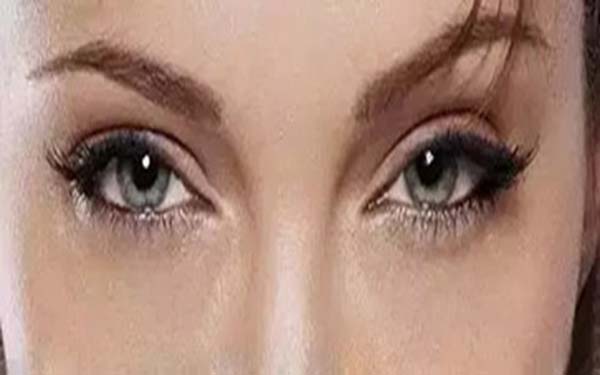 <a href=http://www.f3bb6.cn/listinfo-711-0.html target=_blank class=infotextkey>開眼角</a>手術恢復期