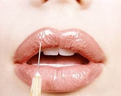 溶解酶幾天后能填充脂肪