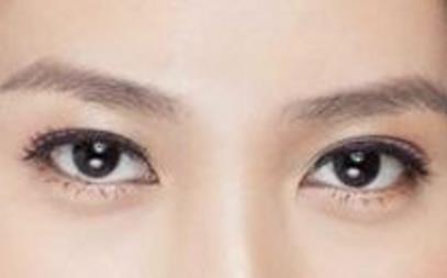 怎樣<a href=http://www.f3bb6.cn/listinfo-708-0.html target=_blank class=infotextkey>去眼袋</a>和皺紋