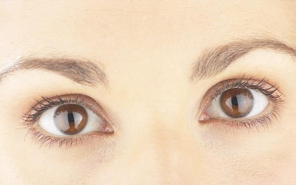 眼部<a href=http://www.f3bb6.cn/listinfo-614-0.html target=_blank class=infotextkey>除皺</a>手術(shù)價格是多少