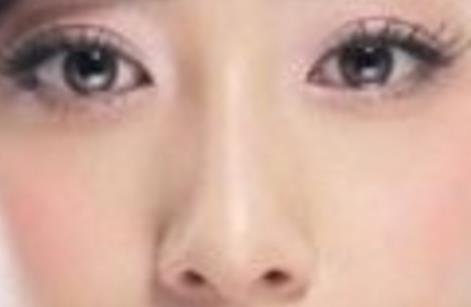 打了溶解酶多久消腫