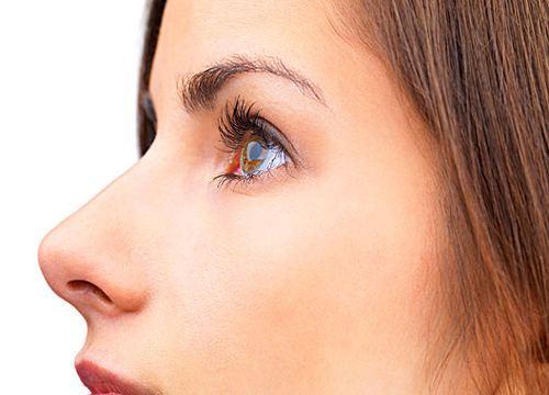 全切<a href=http://www.f3bb6.cn/listinfo-724-0.html target=_blank class=infotextkey>雙眼皮</a>過窄如何修復?