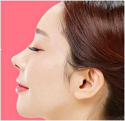 假體<a href=http://www.f3bb6.cn/listinfo-737-0.html target=_blank class=infotextkey>隆鼻</a>多久能恢復(fù)好