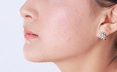 人<a href=http://www.f3bb6.cn/listinfo-631-0.html target=_blank class=infotextkey>瘦臉</a>胖如何做