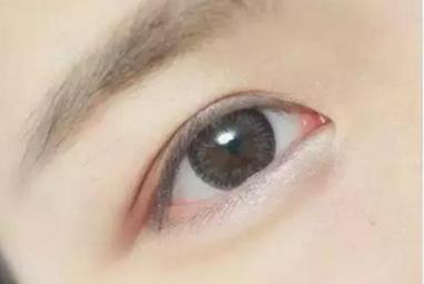 三點(diǎn)式<a href=http://www.f3bb6.cn/listinfo-724-0.html target=_blank class=infotextkey>雙眼皮</a>手術(shù)塑性會(huì)失敗嗎?