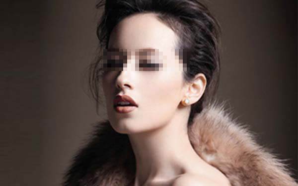 面部肥胖的癥狀及<a href=http://www.f3bb6.cn/listinfo-685-0.html target=_blank class=infotextkey>吸脂</a><a href=http://www.f3bb6.cn/listinfo-631-0.html target=_blank class=infotextkey>瘦臉</a>效果