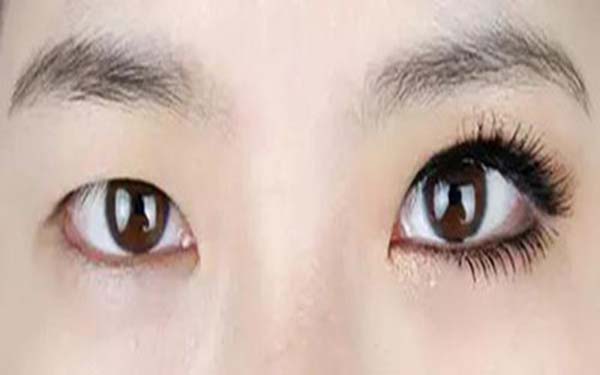 <a href=http://www.f3bb6.cn/listinfo-724-0.html target=_blank class=infotextkey>雙眼皮</a>拆線到底疼不疼