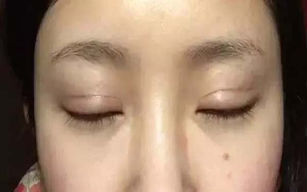 <a href=http://www.f3bb6.cn/listinfo-724-0.html target=_blank class=infotextkey>雙眼皮</a>拆線后多久可以化妝