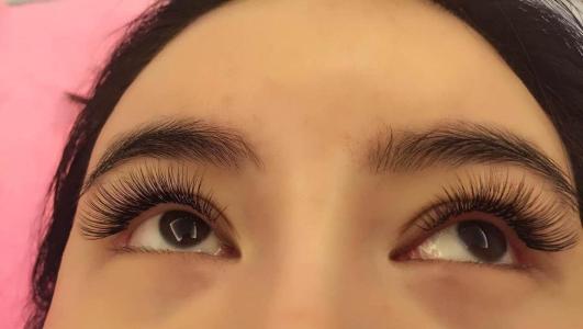 全切<a href=http://www.f3bb6.cn/listinfo-724-0.html target=_blank class=infotextkey>雙眼皮</a>整形多久寬度就不會在變了？