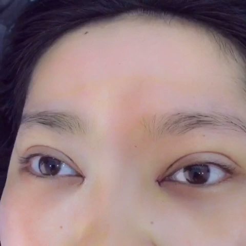 <a href=http://www.f3bb6.cn/listinfo-724-0.html target=_blank class=infotextkey>雙眼皮</a>麻藥注射有哪些方式