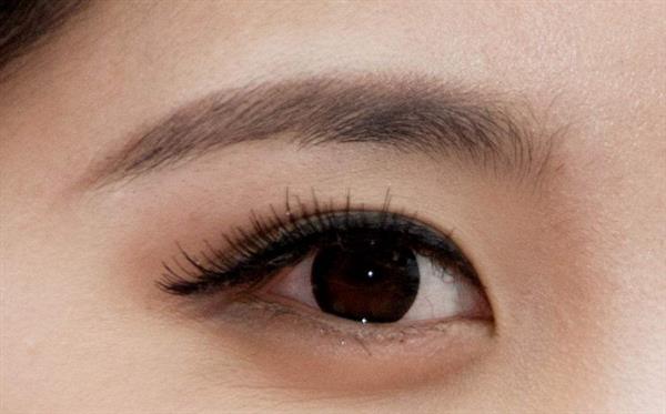 開外眼角怎樣避免回縮