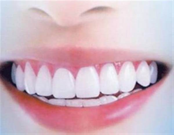 牙齒怎么變白小妙招