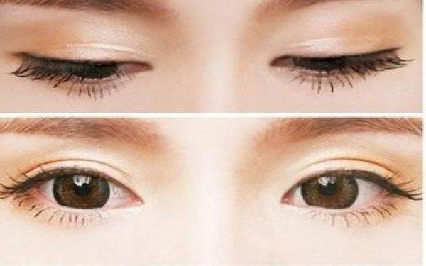 韓美切<a href=http://www.f3bb6.cn/listinfo-724-0.html target=_blank class=infotextkey>雙眼皮</a>多少錢