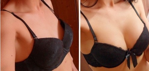 硅膠<a href=http://www.f3bb6.cn/listinfo-618-0.html target=_blank class=infotextkey>隆胸</a>的價格