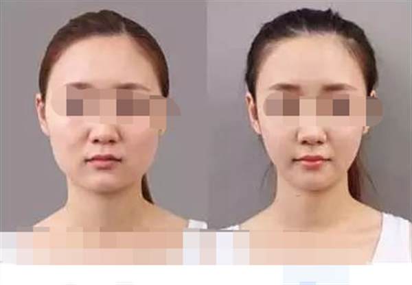 學生有效的<a href=http://www.f3bb6.cn/listinfo-631-0.html target=_blank class=infotextkey>瘦臉</a>方法