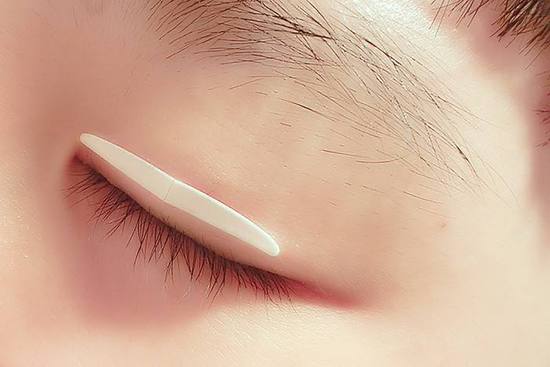 <a href=http://www.f3bb6.cn/listinfo-724-0.html target=_blank class=infotextkey>雙眼皮</a>埋線手術費用大致大致是多少