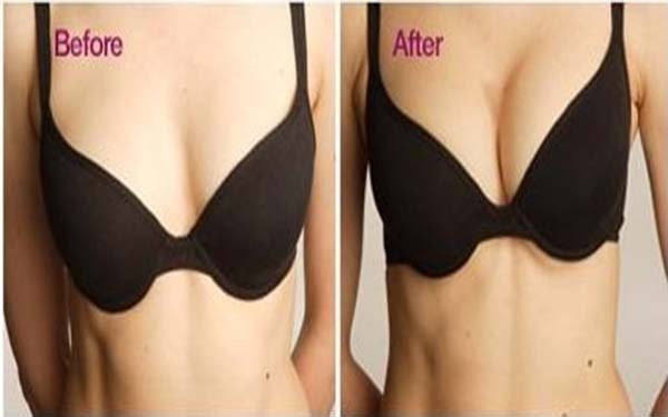 硅膠假體<a href=http://www.f3bb6.cn/listinfo-618-0.html target=_blank class=infotextkey>隆胸</a>會出現后遺癥嗎