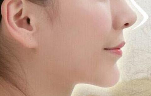 假體<a href=http://www.f3bb6.cn/listinfo-737-0.html target=_blank class=infotextkey>隆鼻</a>注意事項